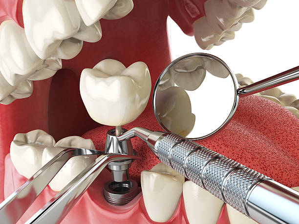 Best Emergency Treatment for Toothache in Salem, OR